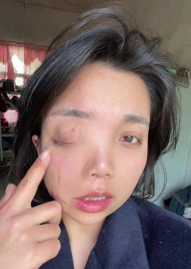 皇冠信用网怎么开户_安徽女子左眼失明皇冠信用网怎么开户,办理残疾人证被拒?残联:双眼残疾可办理