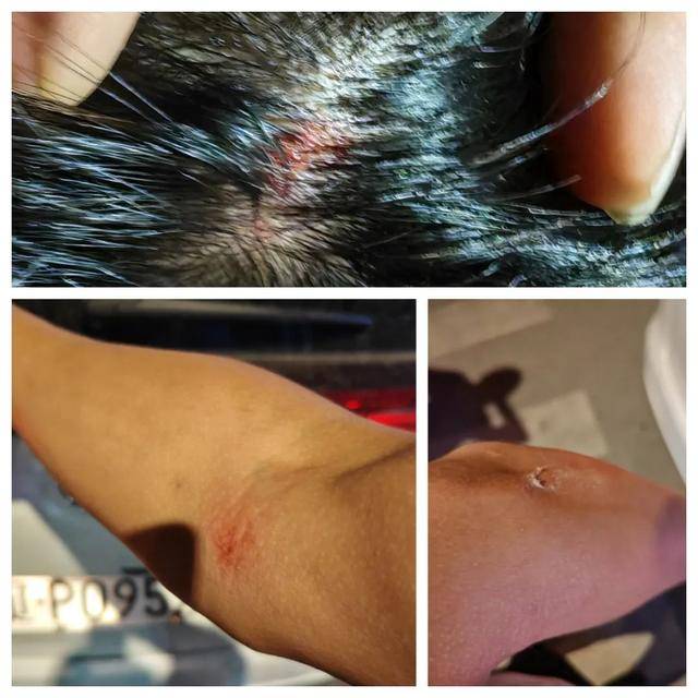 皇冠信用网怎么代理
_向前一横！辽P0952警皇冠信用网怎么代理
，救下5个孩子