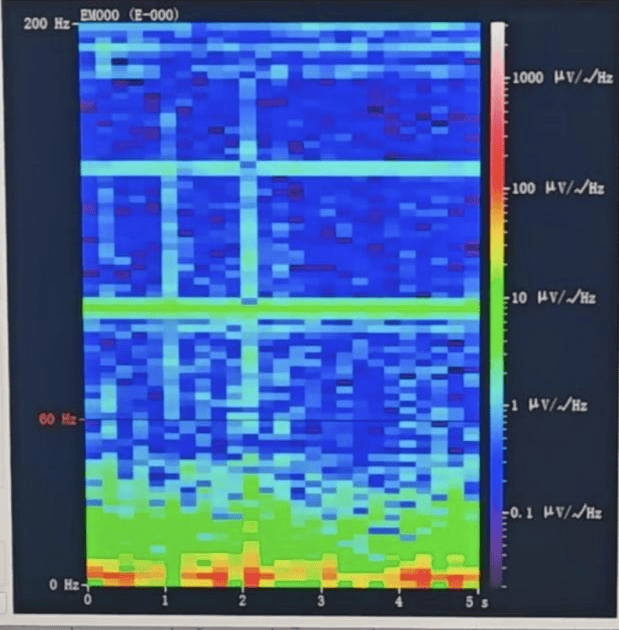 皇冠信用盘登1,登2,登3出租
_山西首例皇冠信用盘登1,登2,登3出租
！山西省人民医院成功实施脑机接口辅助功能区脑肿瘤切除手术